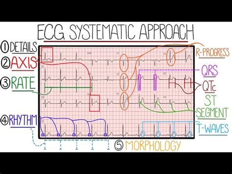 Master ECG Interpretation .